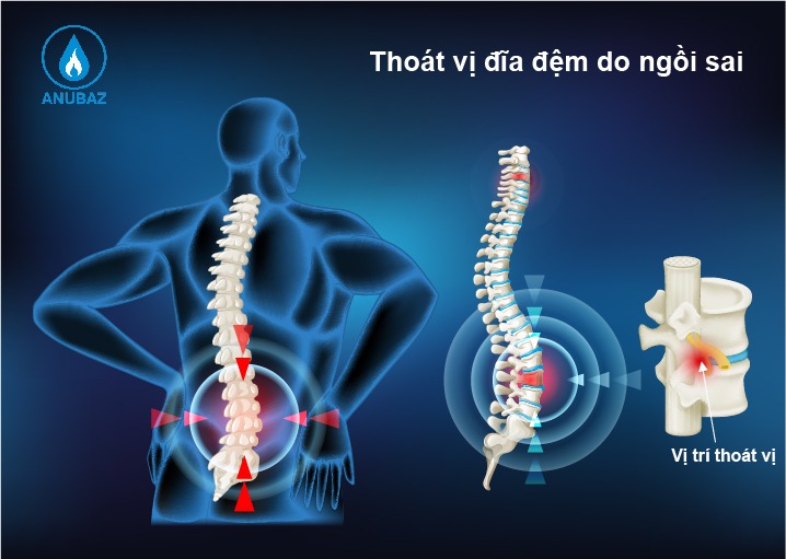 đau thắt lưng bên phải